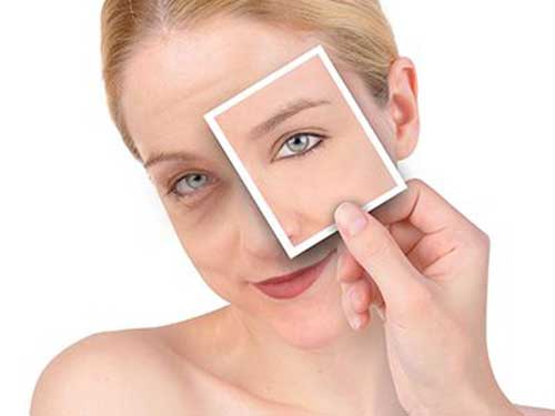 女人吃葡萄籽的好处 保护肌肤抗衰老-葡萄籽(O