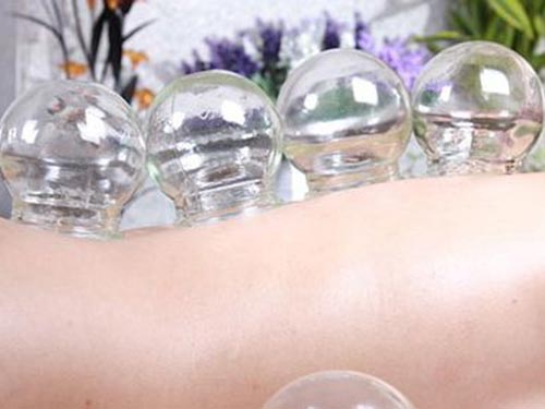 拔罐减肥的利弊