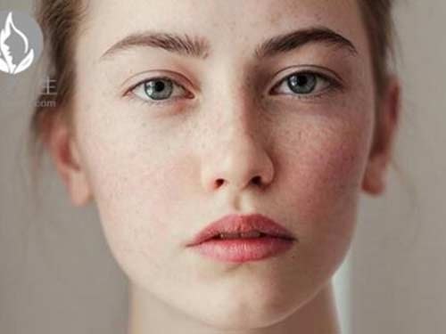 女人脸上长斑是什么原因 女人脸上长斑怎么办