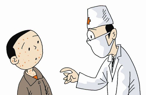 得了水痘可以洗澡吗?