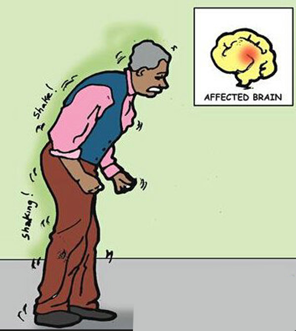 老人走路变慢 警惕帕金森病-帕金森(Parkinson)-中国美容美体网
