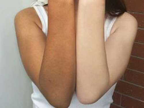 eft防晒隔离霜夏天晒黑了怎么办