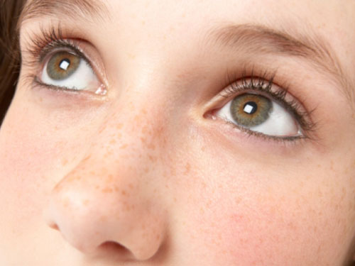 女人脸上黄褐斑怎么祛?天狮让你恢复嫩白肌肤