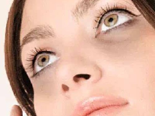 怎样去泪沟型黑眼圈