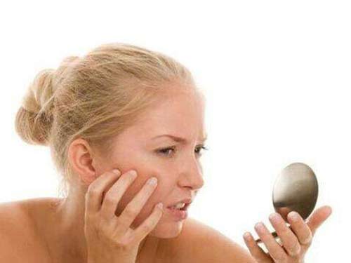 白头粉刺应该怎么去除