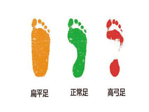 扁平足怎么判断